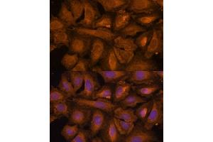 Immunofluorescence analysis of U-2 OS cells using STUB1 Polyclonal Antibody (ABIN6129459, ABIN6148649, ABIN6148650 and ABIN6215447) at dilution of 1:100 (40x lens). (STUB1 抗体  (AA 1-303))