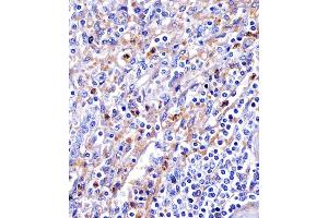 (ABIN6244292 and ABIN6578679) staining Transferrin in human spleen tissue sections by Immunohistochemistry (IHC-P - paraformaldehyde-fixed, paraffin-embedded sections). (Transferrin 抗体  (AA 432-466))