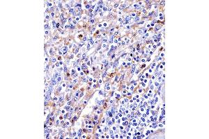 (ABIN6244292 and ABIN6578679) staining Transferrin in human spleen tissue sections by Immunohistochemistry (IHC-P - paraformaldehyde-fixed, paraffin-embedded sections).