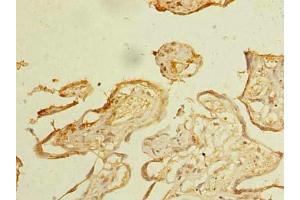 Immunohistochemistry (IHC) image for anti-Zinc Finger, DHHC-Type Containing 3 (ZDHHC3) (AA 94-171) antibody (ABIN7162550)