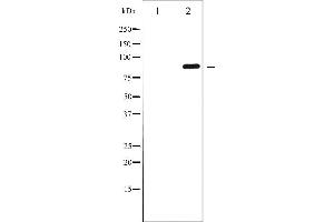 Western blot analysis of GluR2 phosphorylation expression in Mouse brain tissue lysates,The lane on the left is treated with the antigen-specific peptide. (GRIA2 抗体  (pSer880))