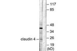 Western blot analysis of extracts from HeLa cells, using Claudin 4 Antibody.