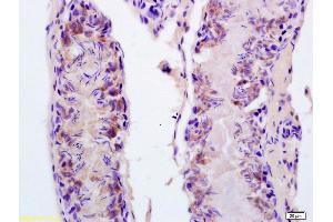 Formalin-fixed and paraffin embedded rat testis labeled with Anti-FASTKD5 Polyclonal Antibody, Unconjugated (ABIN873208) at 1:200 followed by conjugation to the secondary antibody and DAB staining (FASTKD5 抗体  (AA 501-600))