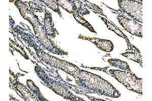IHC analysis of Claudin18/CLDN18 using anti-Claudin18/CLDN18 antibody (ABIN7601257). (Claudin 18 抗体  (AA 31-261))
