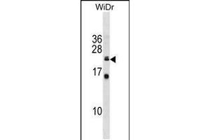 Western blot analysis in WiDr cell line lysates (35ug/lane). (ISCU 抗体  (C-Term))