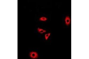 Immunofluorescent analysis of GLUD2 staining in A549 cells. (GLUD2 抗体)
