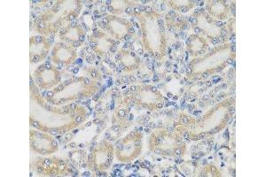Immunohistochemistry of paraffin-embedded Rat kidney using PYCR1 Polyclonal Antibody at dilution of 1:200 (40x lens). (PYCR1 抗体)