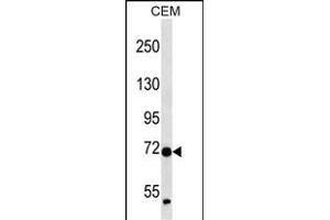 ZN Antibody (N-term ) (ABIN657252 and ABIN2837915) western blot analysis in CEM cell line lysates (35 μg/lane). (ZNF443 抗体  (N-Term))