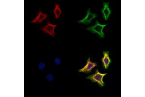 ABIN6265308 and ABIN6273168 staining Hela cells by IF/ICC.