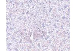 Immunohistochemistry of PLXDC1 in mouse liver tissue with PLXDC1 polyclonal antibody  at 2.