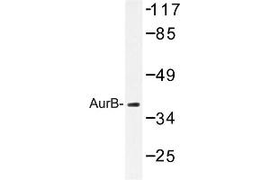 Image no. 1 for anti-Aurora Kinase B (AURKB) antibody (ABIN272108) (Aurora Kinase B 抗体)