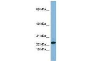 Image no. 1 for anti-Small Proline-Rich Protein 3 (SPRR3) (C-Term) antibody (ABIN6741688) (SPRR3 抗体  (C-Term))
