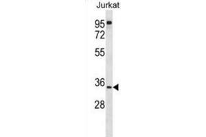 Western Blotting (WB) image for anti-UBX Domain Protein 8 (UBXN8) antibody (ABIN2998959) (UBXN8 抗体)