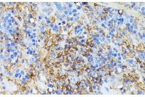 Immunohistochemistry of paraffin-embedded Rat spleen using COX15 Polyclonal Antibody at dilution of 1:100 (40x lens). (COX15 抗体)