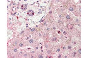 Immunohistochemistry (IHC) image for anti-Ral GEF with PH Domain and SH3 Binding Motif 1 (RALGPS1) (AA 326-375) antibody (ABIN6754896)