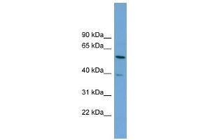 TOM1 antibody used at 1 ug/ml to detect target protein. (TOM1 抗体)