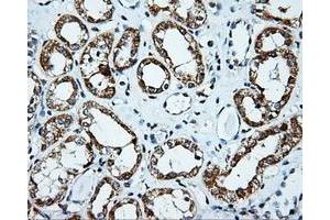 Immunohistochemical staining of paraffin-embedded Kidney tissue using anti-PLEK mouse monoclonal antibody. (Pleckstrin 抗体)