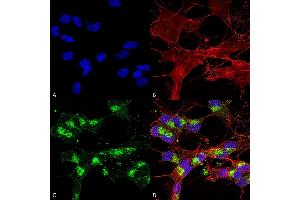 Immunocytochemistry (ICC) image for anti-Voltage-Dependent Anion Channel 1 (VDAC1) (AA 1-283) antibody (PE) (ABIN1741231)