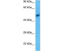 WB Suggested Anti-ACHA9 antibody Titration: 1 ug/mL Sample Type: Human MCF7 Whole Cell (CHRNA9 抗体  (N-Term))