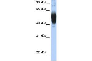 LCAT antibody used at 1 ug/ml to detect target protein.