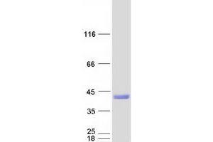 Western Blotting (WB) image for Sorting Nexin 11 (SNX11) (Transcript Variant 1) protein (Myc-DYKDDDDK Tag) (ABIN2732382)
