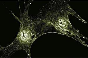 Immnuofluroescence staining of human fibroblasts. (FGF2 抗体  (AA 1-155))