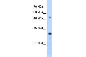 WB Suggested Anti-PSME3 Antibody Titration:  1. (PSME3 抗体  (C-Term))