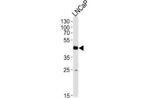 Western Blotting (WB) image for anti-Family with Sequence Similarity 54, Member A (FAM54A) antibody (ABIN3004761) (FAM54A 抗体)
