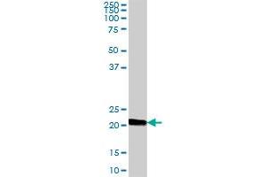 Western Blotting (WB) image for anti-Immunoglobulin J Polypeptide, Linker Protein For Immunoglobulin alpha and mu Polypeptides (IGJ) (AA 1-159) antibody (ABIN516961)