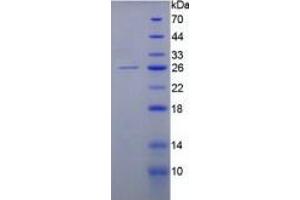 SDS-PAGE of Protein Standard from the Kit  (Highly purified E. (KRT8 ELISA 试剂盒)
