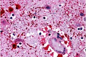 Immunohistochemistry of PIWI-L2 in human brain tissue with PIWI-L2 antibody at 5 µg/mL. (PIWIL2 抗体  (Middle Region))