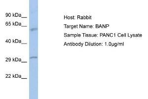 Host: Rabbit Target Name: BANP Sample Type: PANC1 Whole Cell lysates Antibody Dilution: 1. (BANP 抗体  (N-Term))
