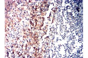 Immunohistochemical analysis of paraffin-embedded tonsil tissues using CD85G mouse mAb with DAB staining.