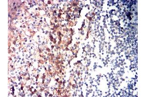 Immunohistochemical analysis of paraffin-embedded tonsil tissues using CD85G mouse mAb with DAB staining. (LILRA4 抗体  (AA 24-178))