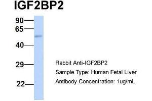 Host:  Rabbit  Target Name:  IGF2BP2  Sample Type:  Human Fetal Liver  Antibody Dilution:  1. (IGF2BP2 抗体  (Middle Region))
