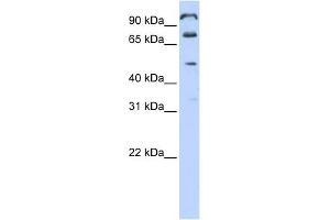 WB Suggested Anti-C10orf38 Antibody Titration:  0. (FAM171A1 抗体  (Middle Region))