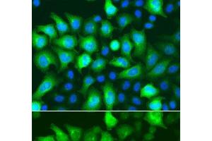 Immunofluorescence analysis of A549 cells using RRM2 Polyclonal Antibody (RRM2 抗体)