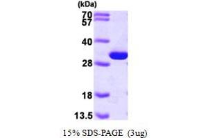 SDS-PAGE (SDS) image for phosphoglycerate Mutase 1 (Brain) (PGAM1) (AA 1-254) protein (His tag) (ABIN667196) (PGAM1 Protein (AA 1-254) (His tag))