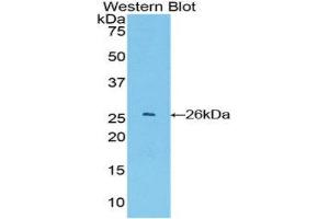 Western Blotting (WB) image for anti-Glutathione S-Transferase alpha 4 (GSTA4) (AA 1-222) antibody (ABIN1078080) (GSTA4 抗体  (AA 1-222))