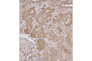 Immunohistochemical analysis of (ABIN392043 and ABIN2841811) on paraffin-embedded Human kidney tissue. (ROR1 抗体)