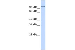 WB Suggested Anti-PDXDC1 Antibody Titration: 0. (PDXDC1 抗体  (N-Term))