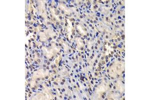 Immunohistochemistry (Paraffin-embedded Sections) (IHC (p)) image for anti-DEAD (Asp-Glu-Ala-Asp) Box Polypeptide 41 (DDX41) (AA 1-300) antibody (ABIN6139498)