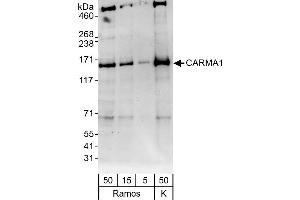 Western Blotting (WB) image for anti-Caspase Recruitment Domain Family, Member 11 (CARD11) (AA 275-325) antibody (ABIN7451676)