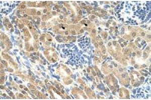 Immunohistochemical staining (Formalin-fixed paraffin-embedded sections) of human kidney with IHH polyclonal antibody  at 4-8 ug/mL working concentration. (Indian Hedgehog 抗体  (N-Term))