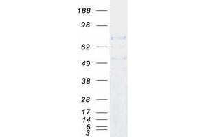 Western Blotting (WB) image for Dynein, Axonemal, Intermediate Chain 1 (DNAI1) protein (Myc-DYKDDDDK Tag) (ABIN2719563)