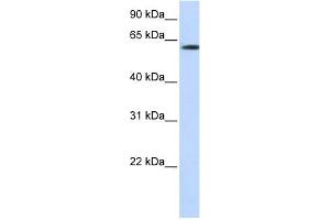 WB Suggested Anti-FBXO24 Antibody Titration:  0. (FBXO24 抗体  (N-Term))