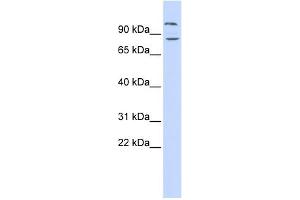 WB Suggested Anti-DAGLB Antibody Titration: 0. (DAGLB 抗体  (Middle Region))