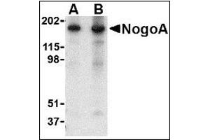 Image no. 2 for anti-Reticulon 4 (RTN4) (N-Term) antibody (ABIN372912) (Reticulon 4 抗体  (N-Term))