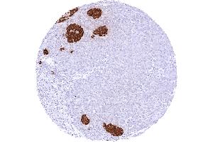 Pancreas with a strong cytoplasmic insulin staining of the majority of islet cells (Recombinant Insulin 抗体)