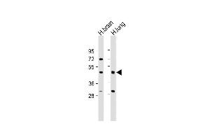 All lanes : Anti-IFT57 Antibody (Center) at 1:2000 dilution Lane 1: Human brain lysate Lane 2: Human lung lysate Lysates/proteins at 20 μg per lane. (IFT57 抗体  (AA 159-193))